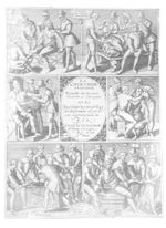 La chirurgie française de Jacques Guillemeau