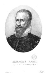 Paré, Ambroise (1510-1590)