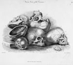Various views of the cranium - The principles of surgery
