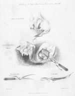 Sketches of Le Cat's & Frere Cosme's operations - The principles of surgery