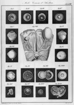 Morbi corneae et scleroticae - Klinische Darstellungen der Krankheiten des menschlichen Auges nach e [...]