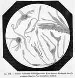 Cellules fusiformes étoilées provenant d'une tumeur développée dans la substance blanche d'un hémisp [...]