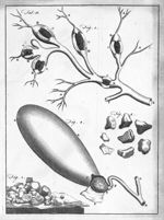 Four examples of biliary calculi found by dissections - A treatise on biliary concretions