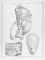 [Utérus dans l'état de grossesse, avec les viscères de l'abdomen] - Manuel d'anatomie descriptive du [...]