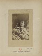 Planche XXVI. Hystéro-épilepsie : 3e période - Iconographie photographique de la Salpêtrière : servi [...]