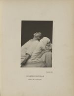 Planche IX. Epilepsie partielle. Début de l'attaque - Iconographie photographique de la Salpêtrière  [...]