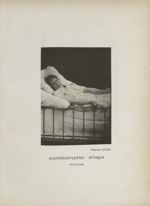 Planche XXXII. Hystéro-épilepsie : attaque. Tétanisme - Iconographie photographique de la Salpêtrièr [...]