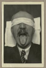 [Portrait d'un homme en position dorsale, de face, les yeux bandés, langue tirée montrant une attein [...]