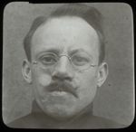 [Plaque photographique de projection. Portrait de face après pose de prothèse nasale et lunettes de  [...]