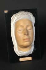 Lupus tuberculo-ulcéreux de la face, guéri. Femme âgée de 30 ans, couturière (V. le n° 72, même mala [...]