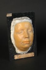 Syphilide papulo-squameuse de la face (moulage décoloré, Inv. 1922) (V. le n° 219, dos du même malad [...]