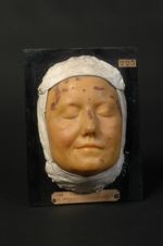 Éruption huileuse de la face, provoquée par la poudre de cantharide appliquée dans un but de simulat [...]