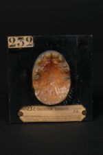 Lupus tuberculeux ulcéreux du palais. Femme âgée de 39 ans, domestique (V. le n° 238, face de la mêm [...]