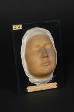 Lupus érythémateux (Inv. 1889) de la face (moulage décoloré, Inv. 1922). Homme âgé de 22 ans, domest [...]