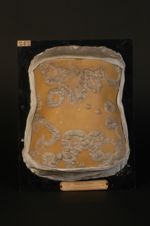 Psoriasis circiné rupioïde. Homme âgé de 22 ans, commis