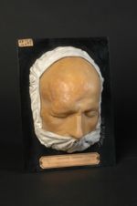 Syphilide tuberculeuse en nappe du front et du cuir chevelu. Homme âgé de 48 ans, journalier