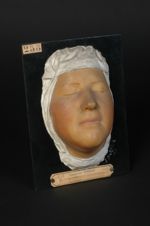 Lupus érythémateux de la face, du type Erythème centrifuge de Biett (Inv. 1922). Femme âgée de 16 an [...]