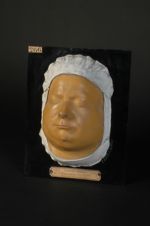 Tuberculose ganglionnaire cervicale pseudo-leucémique (Inv. 1922). Homme âgé de 19 ans, cartonnier.  [...]