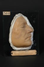 Lupus érythémateux de la face ; herpès crétacé de Devergie (Inv. 1922). Homme âgé de 43 ans, journal [...]