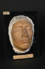 Lupus érythémateux circiné de la face ; érythème centrifuge de Biett, forme acnéique superficielle.  [...]