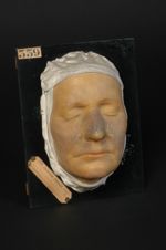 Lupus érythémateux de la face ayant simulé un eczéma. Femme âgée de 45 ans, domestique