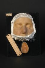 Lupus tuberculeux de la face et de la voûte du palais ; tubercules isolés ; tubercules agminés. Femm [...]