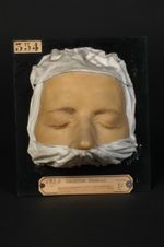 Molluscum contagiosum de Bateman. Acné varioliforme des paupières et des régions voisines de la face [...]