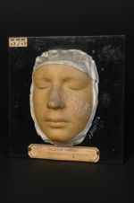 Lupus érythémateux de la face ; herpès crétacé de Devergie (moulage décoloré) (Inv. 1922). Femme âgé [...]
