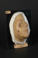 Gommes tuberculeuses, gomme périostique, gommes dermiques, de la face. Homme âgé de 15 ans, sans pro [...]