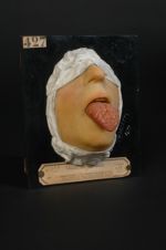 Langue scrotale (Inv. 1922). Anomalie de la langue par exagération congénitale des sillons normaux.  [...]