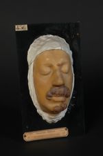 Plaques syphilitiques de la peau hypertrophiques. Condylomes plats ; condylomes syphilitiques. Homme [...]