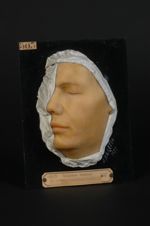 Impétigo de la face, guéri après quatre jours de traitement. (V. le n° 487 [STLCGE00487], même malad [...]