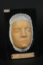 Lèpre maculeuse, lèpre pityriasique, pityriasis lépreux. Pays habité : le Brésil