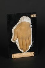 Xanthôme, xanthélasma ; variété tubéreuse (V. les n° 542, gland et main, et 543, face palmaire de la [...]