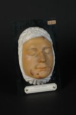 Lésion indéterminée de la face