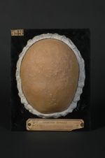 Favus du cuir chevelu existant depuis 10 ans. Homme âgé de 26 ans ; godets (favi) en reproduction ap [...]