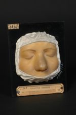 Lupus exedens végétant de la face ; lupus exubérant de Fuchs. Guérison après traitement par les scar [...]