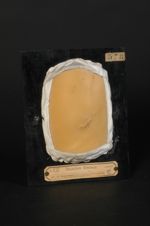 Dermatomyômes ; myômes cutanés, fibro-myômes