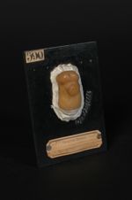 Chancre syphilitique du fourreau de la verge ; variété en plateau