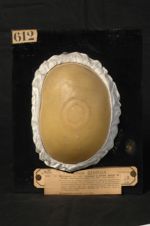 Microsporie (Inv. 1922). Tondante à petites spores de Gruby ; origine équine probable (Inv. 1900). T [...]