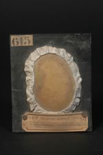 Lupus érythémateux du cuir chevelu