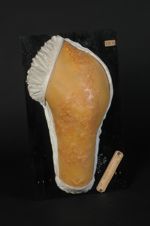 Zona du membre inférieur