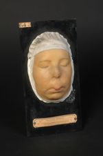 Lupus tuberculo-gommeux de la face ; traitement par les scarifications linéaires (V. le n° 576, même [...]