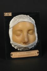 Lupus ulcéreux végétant du nez ; guérison après traitement par les scarifications linéaires (V. le n [...]