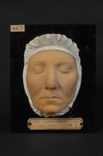 Acné rosée ; acné érythémato-pustuleuse de la face