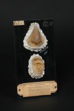 Lupus pernio. Ulcération provoquée du nez. Atrophie cicatricielle de l'hélix (Inv. 1922). Asphyxie l [...]