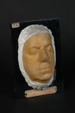 Syphilide papuleuse géante de la face. Homme âgé de 40 ans