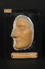 Molluscum contagiosum ; acné varioliforme. Jeune fille âgée de 23 ans, fleuriste