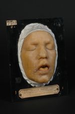 Lèpre tuberculeuse de la face ; léontiasis. Pays habité : Cayenne