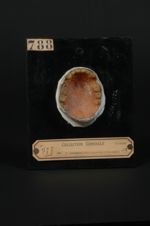 Leucoplasie palatine